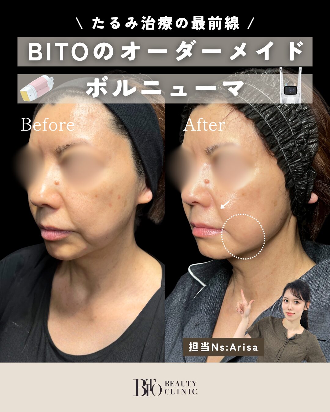 099.ボルニューマ