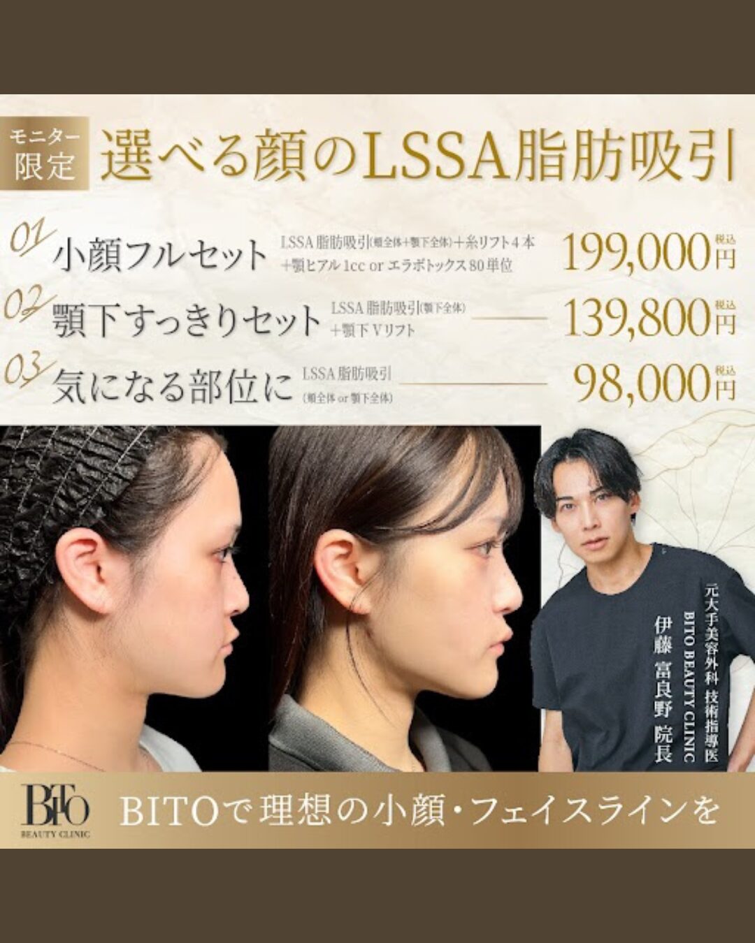 3月キャンペーン:選べる顔のLSSA脂肪吸引