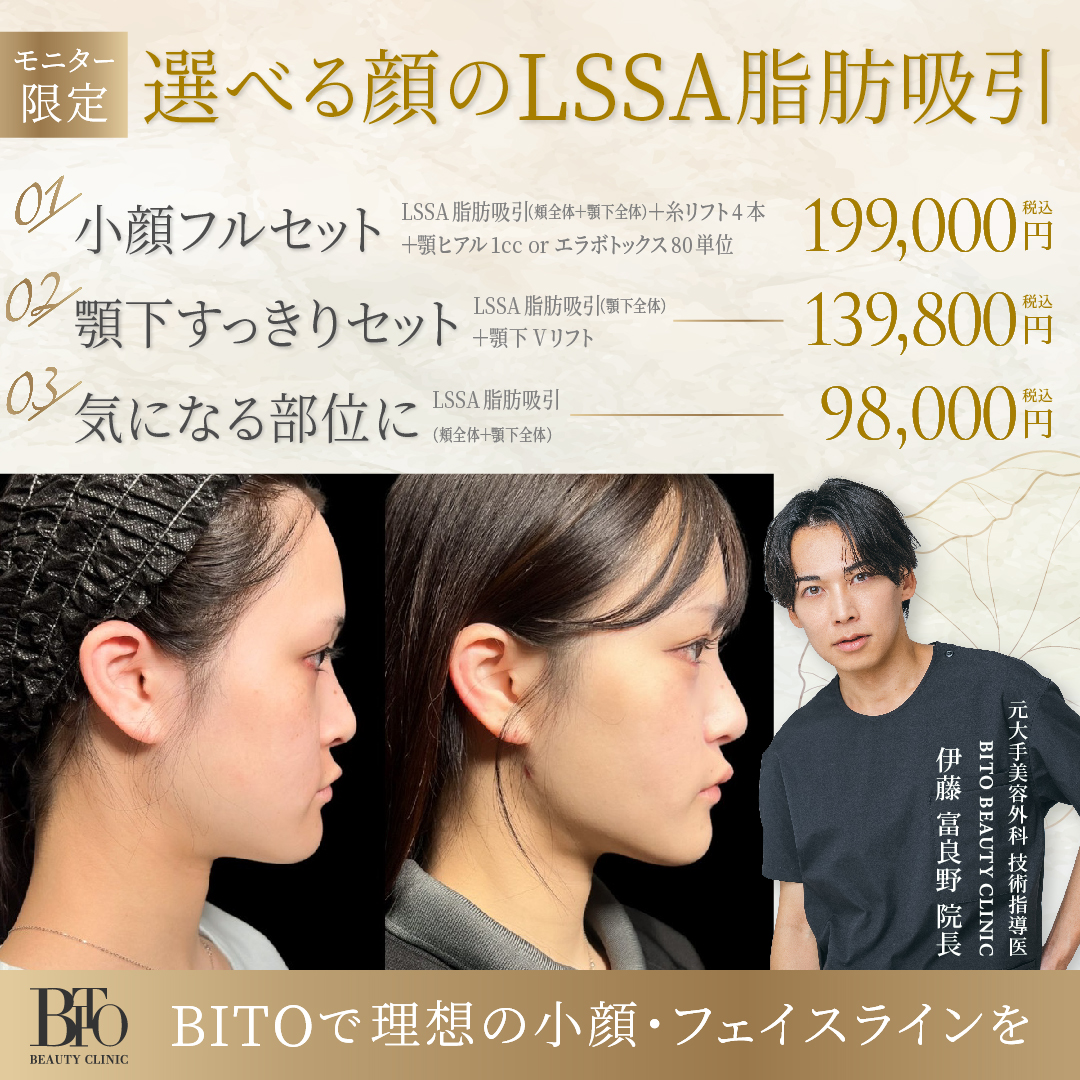 5月キャンペーン:選べる顔のLSSA脂肪吸引