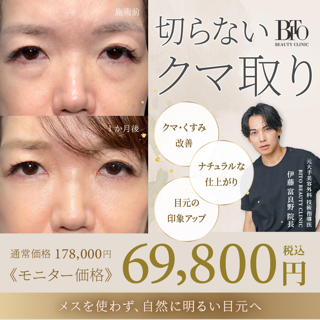 5月キャンペーン:切らないクマ取り(脱脂術)