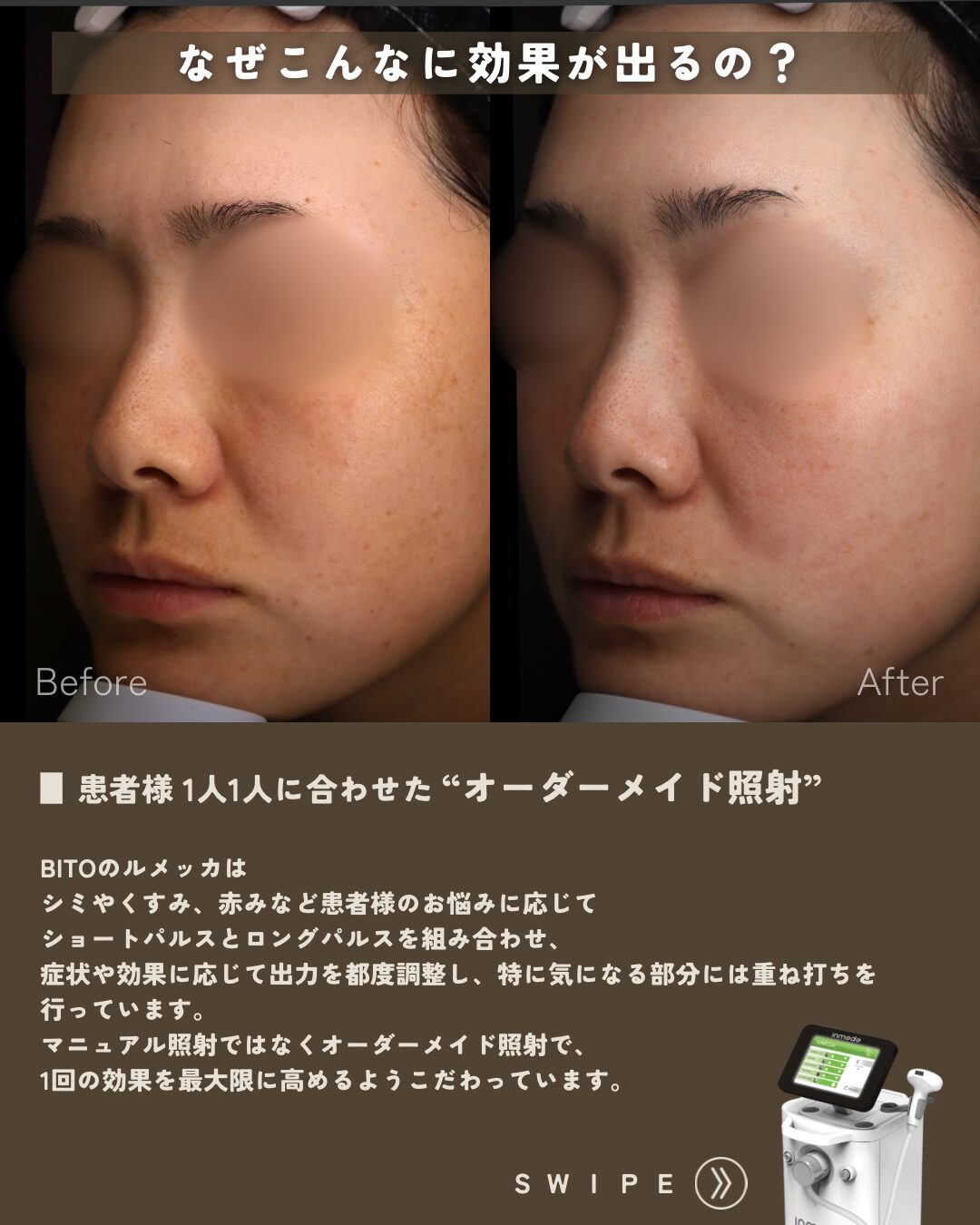 179.ルメッカ,マヌカピール,ケアシス