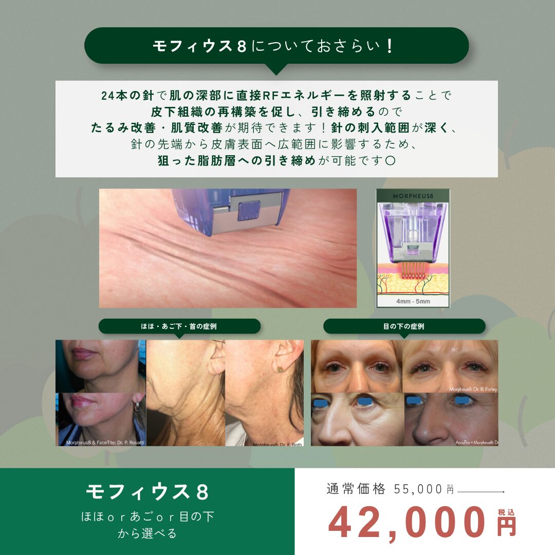 9月キャンペーン : モフィウス(頬or顎下or目の下) ￥42,000
