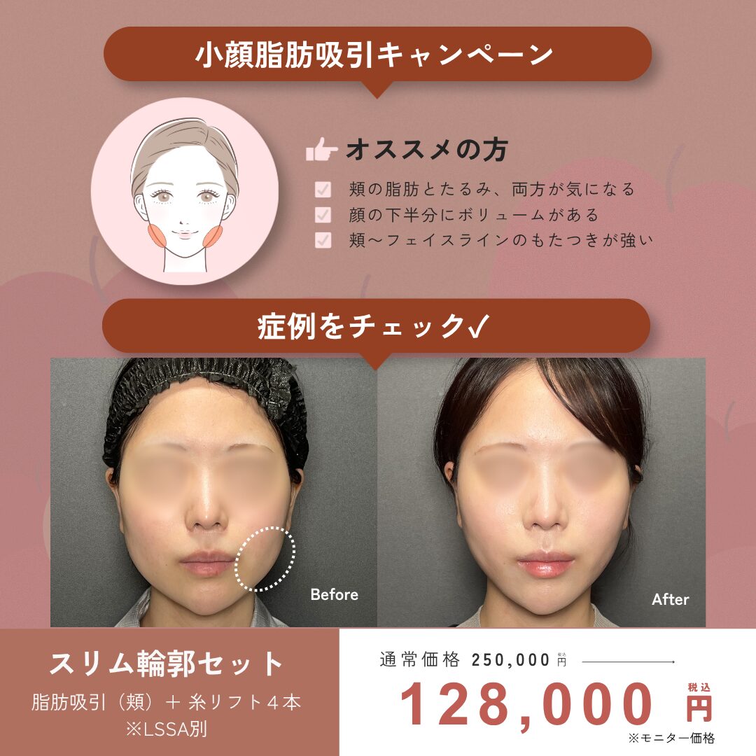 9月キャンペーン : スリム輪郭セット ￥250,000→￥128,000