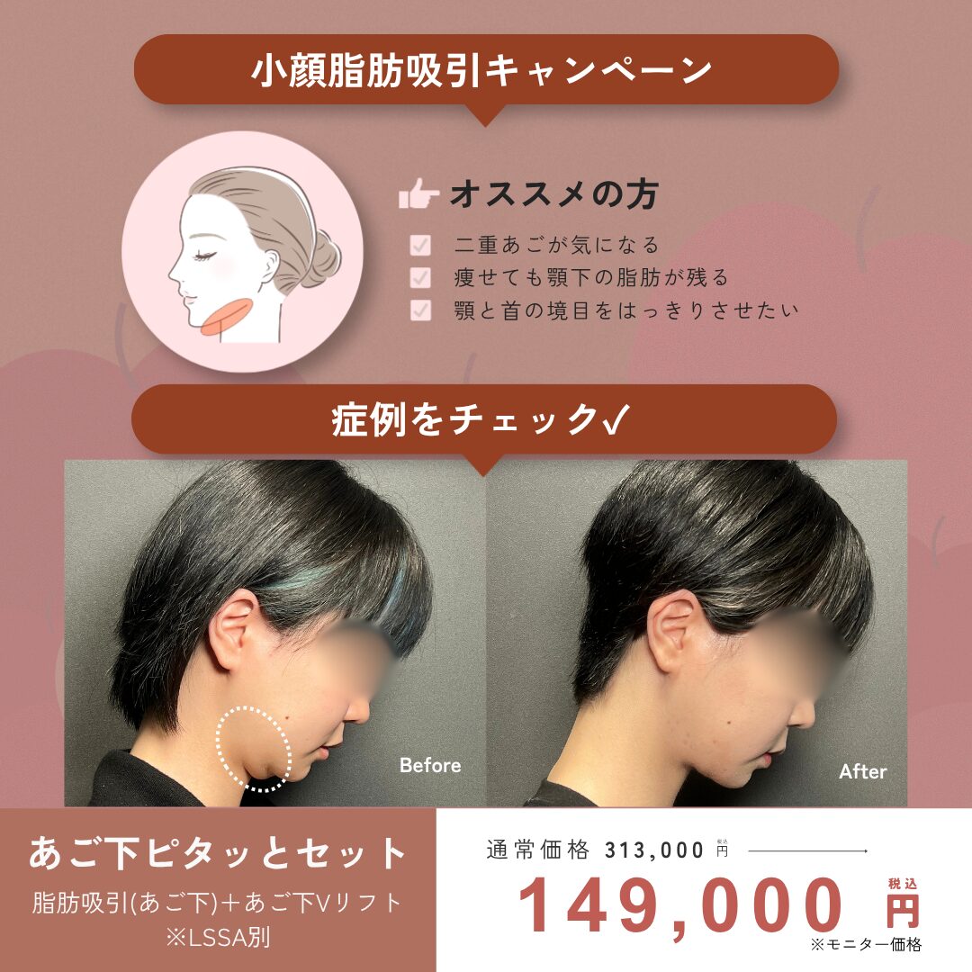 9月キャンペーン : 顎下ピタッとセット ￥313,000 → ￥149,000