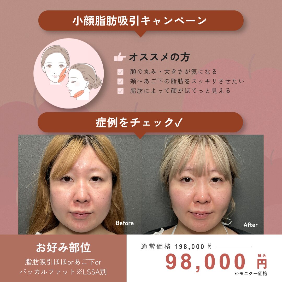 9月キャンペーン : お好み部位 ￥198,000 → ￥98,000