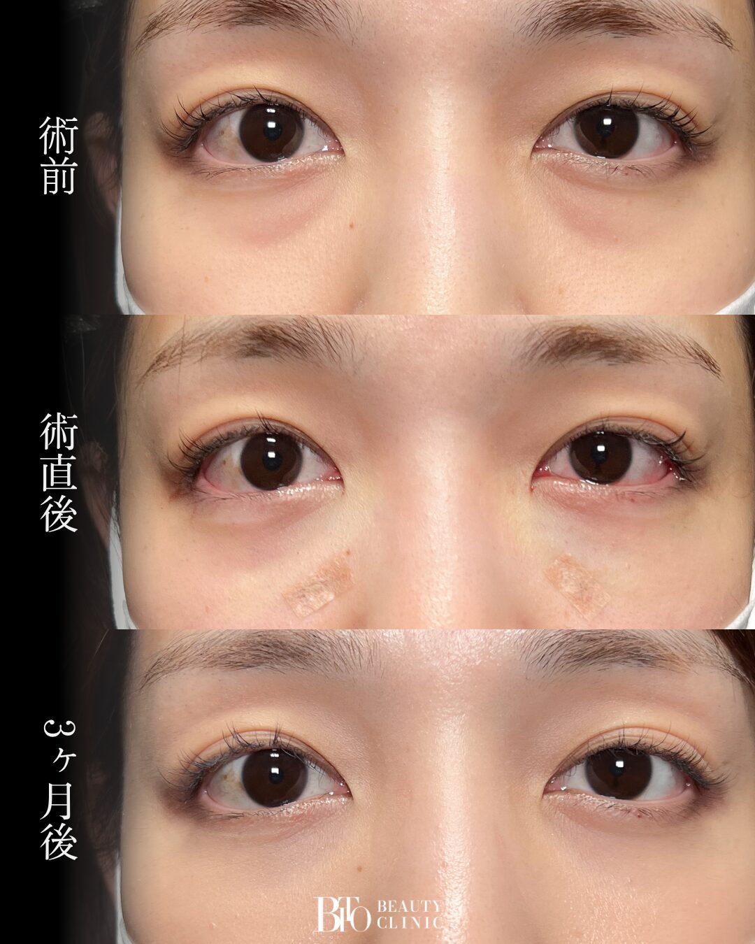 262.20代女性 裏ハムラ