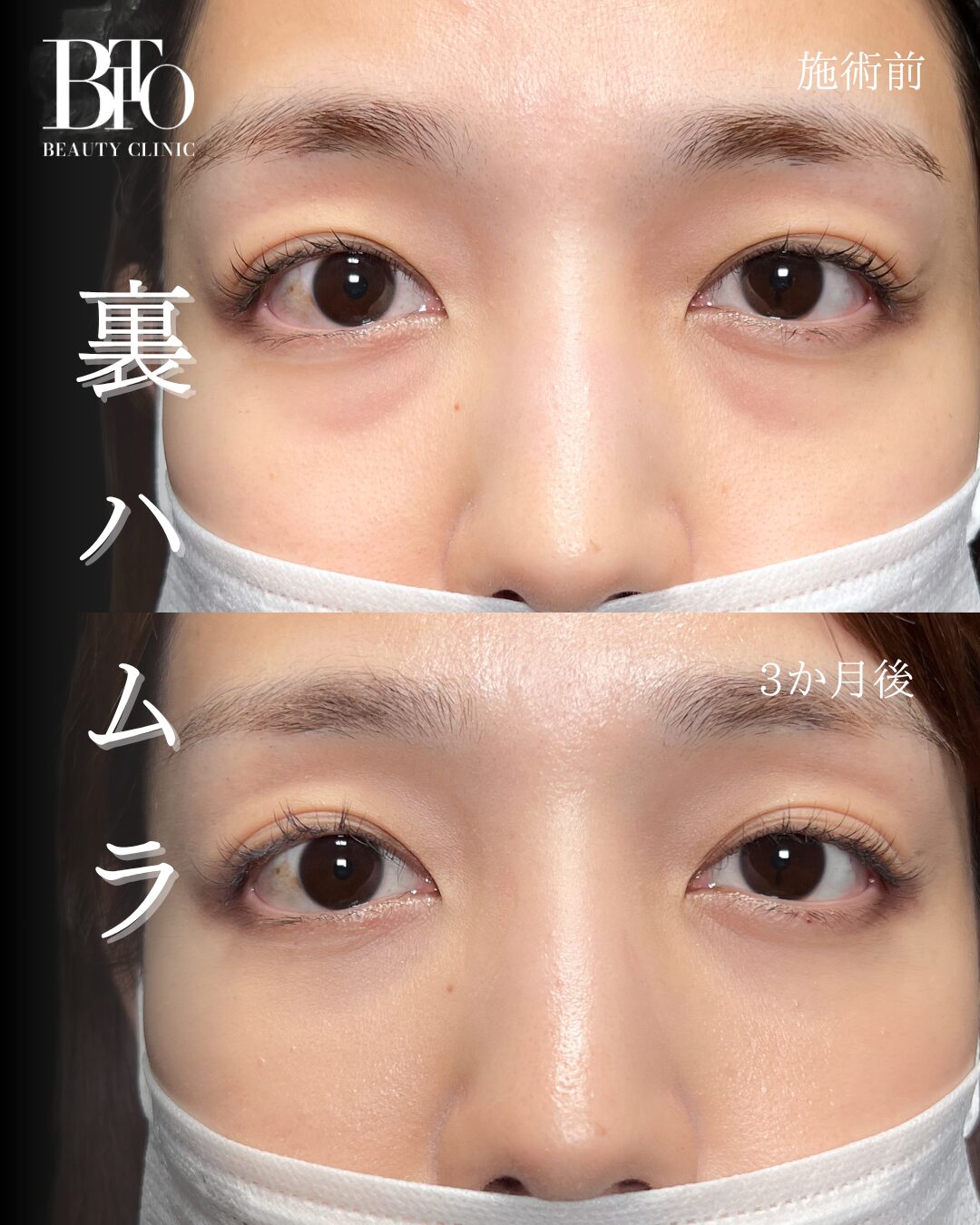 262.20代女性 裏ハムラ