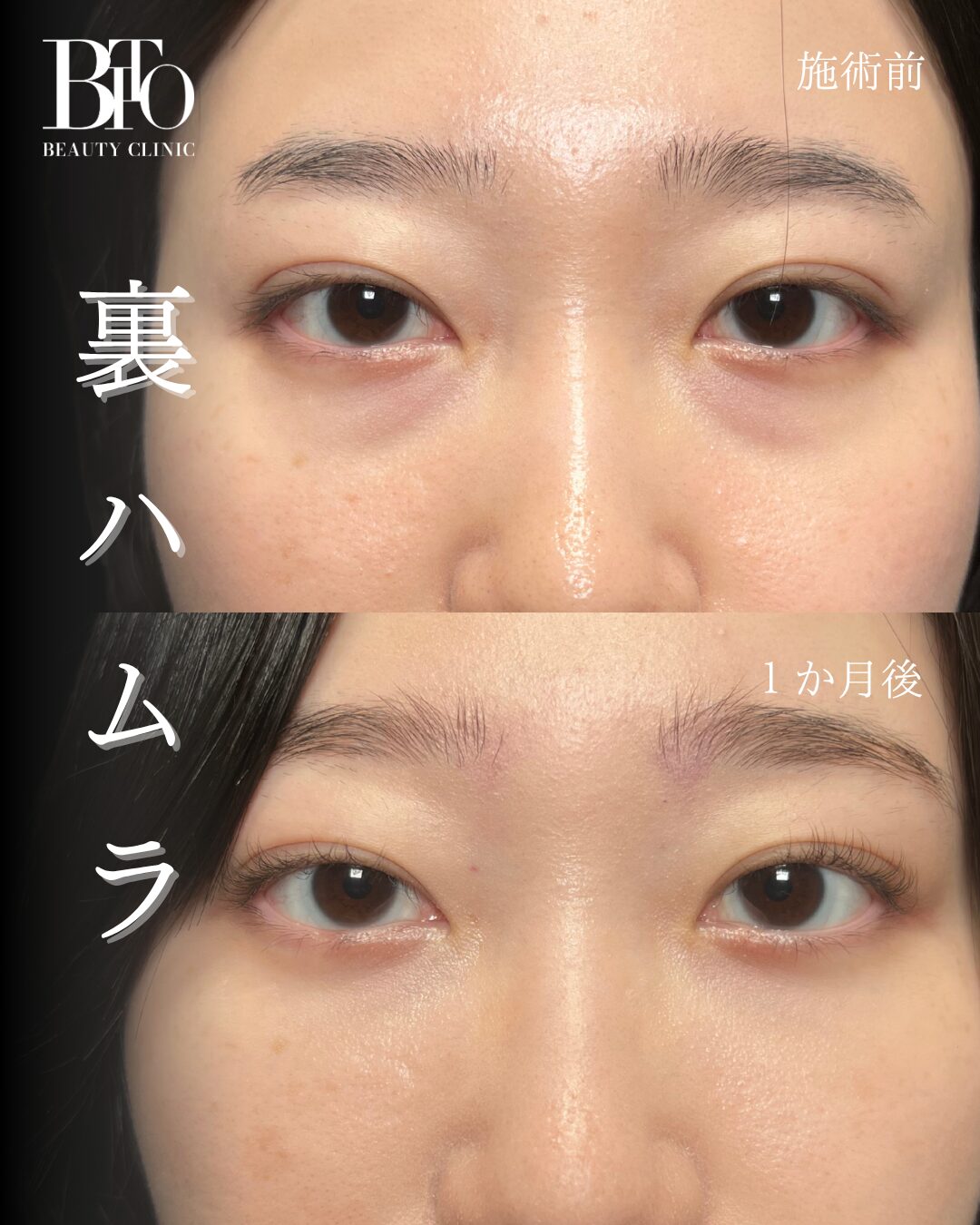 268. 20代女性 裏ハムラ