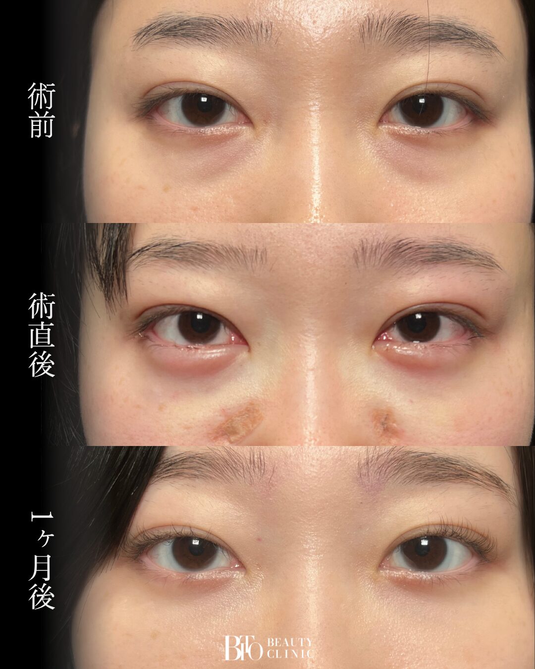 268. 20代女性 裏ハムラ