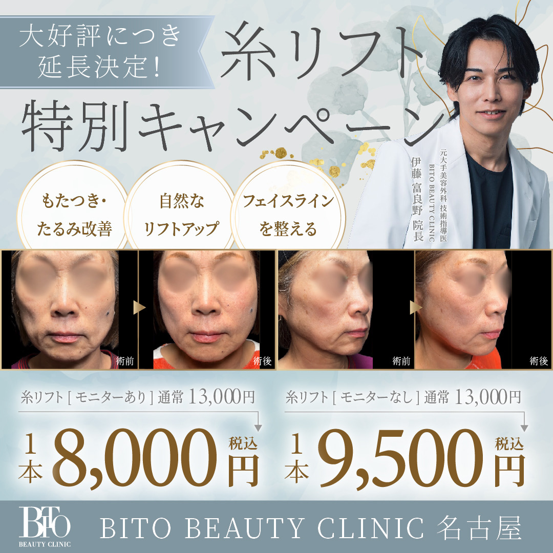 糸リフト 8000円 ※モニター有