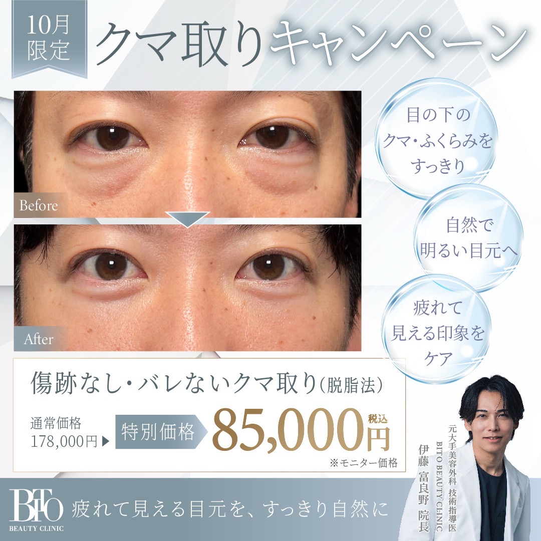 クマ取り(脱脂法) ￥85,000