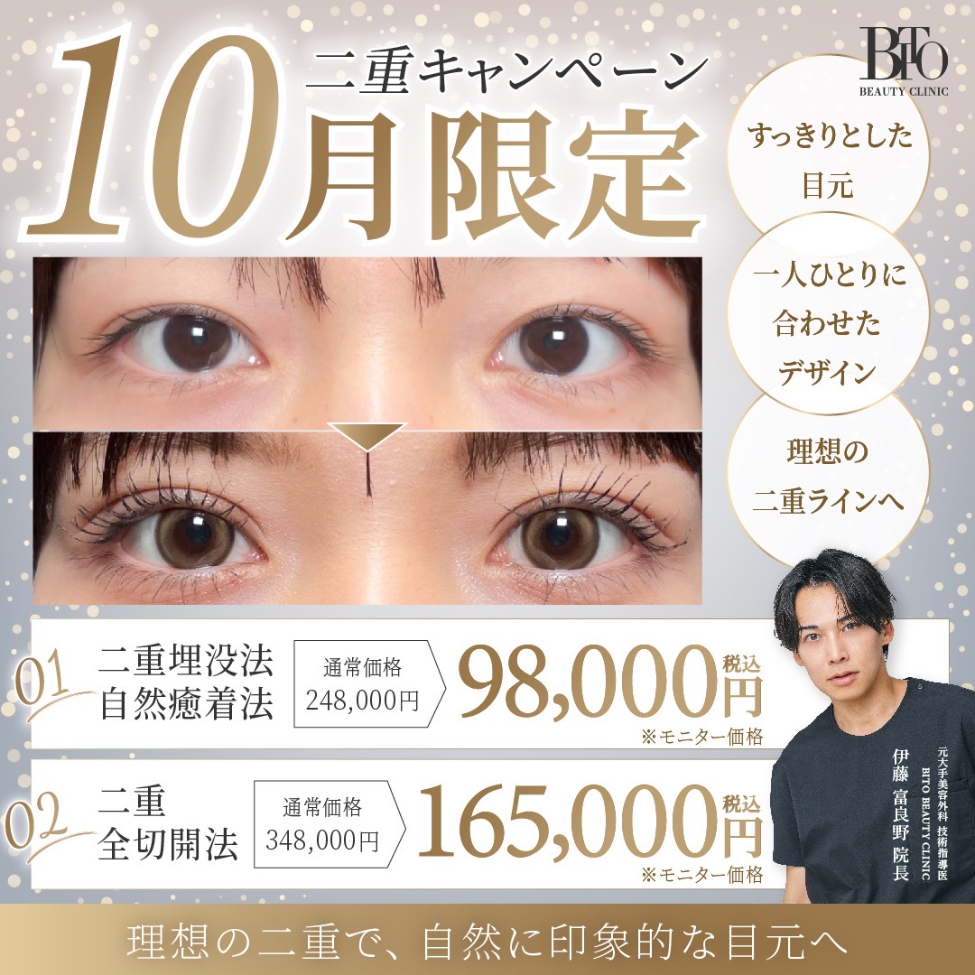 二重全切開法 ￥165,000