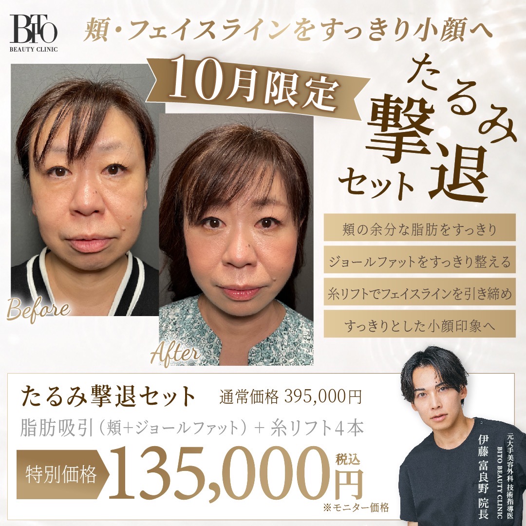 【名古屋】小顔脂肪吸引 たるみ撃退セット ￥135,000