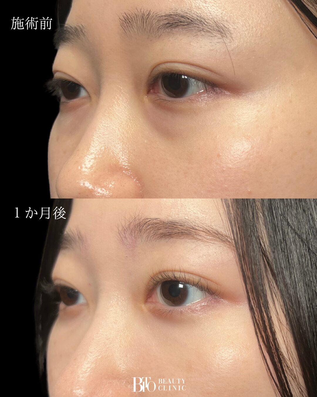 268. 20代女性 裏ハムラ