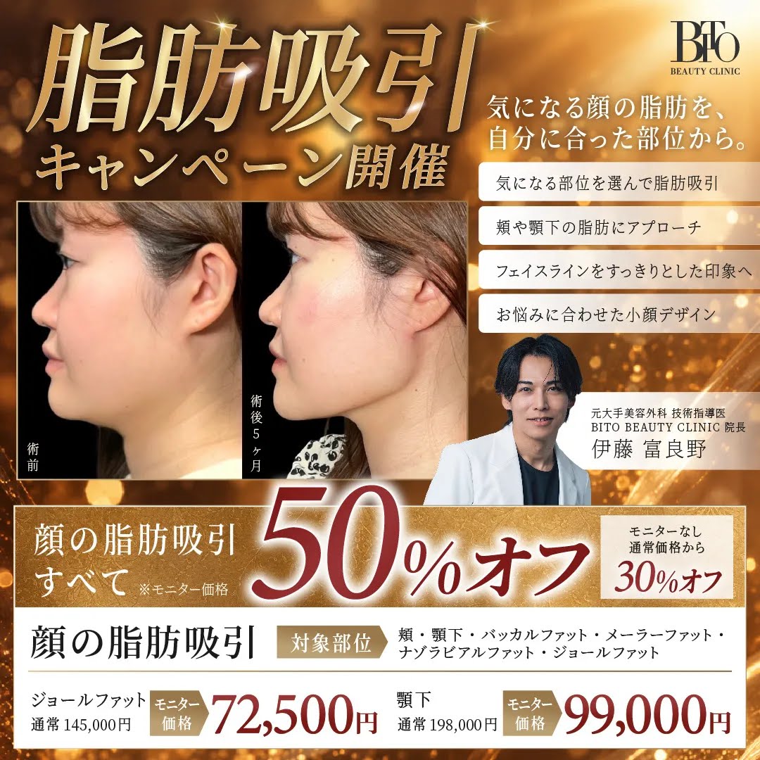 顔の脂肪吸引すべて50％オフ
