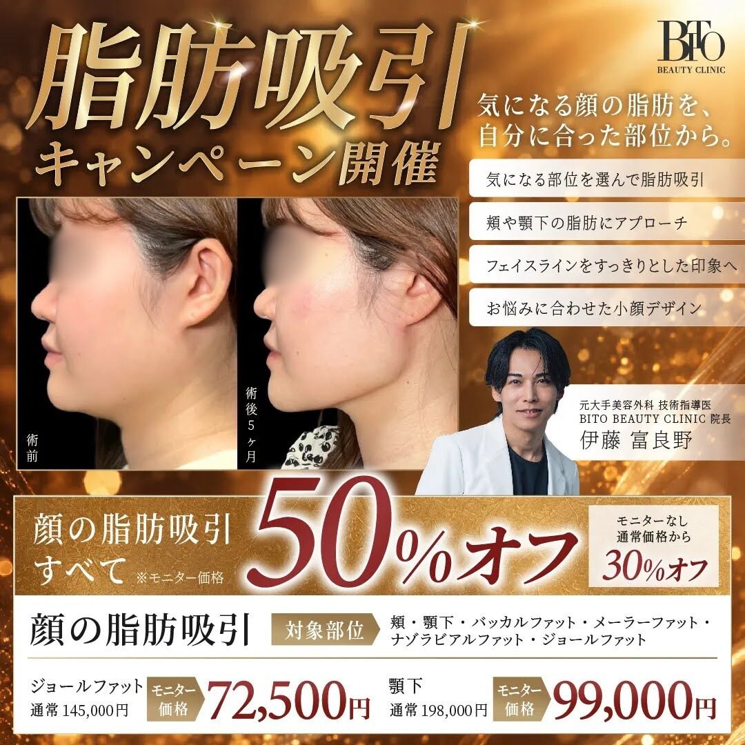 顔の脂肪吸引すべて50％オフ